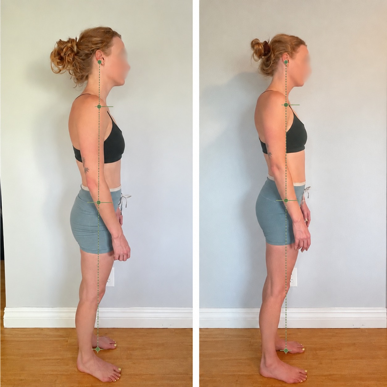 Whole-Body Vertical Alignment — Before and After